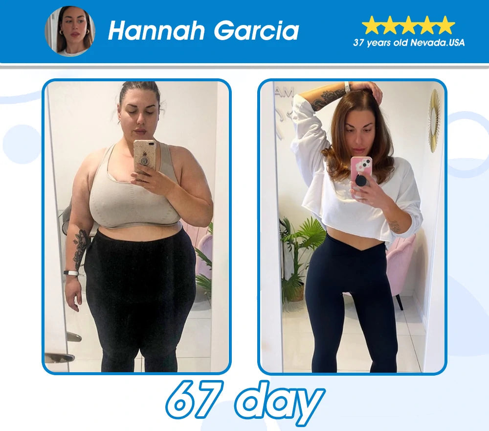 🏥FDA Store | 𝐵uil𝗱𝐿ea𝐟® 𝑺𝑀𝗚T-𝑮𝐋𝑃-1 𝐒limming & 𝐻ealth 𝑁ano 𝑀icroneedle 𝑃atch with Collagen & Matrixyl 3000 丨Obesity,Cardiovascular Diseas, Diabetes, Sleep Apnea, Joint Problems and More