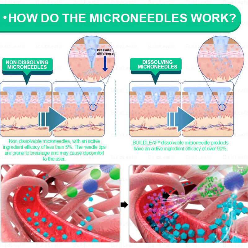 Official Store 🏥| BuildLeaf® GLP-1 Nano-Microneedle Patch with Collagen & Matrixyl 3000 丨Obesity,Cardiovascular Diseas, Diabetes, Sleep Apnea, Joint Problems and More