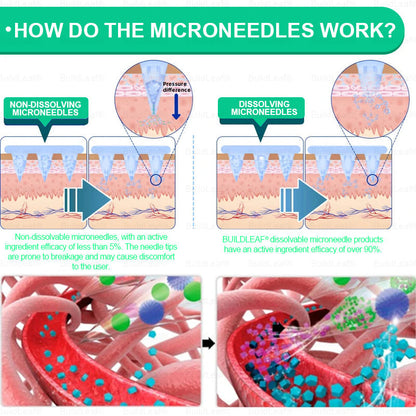 Official Store 🏥| BuildLeaf® GLP-1 Nano-Microneedle Patch with Collagen & Matrixyl 3000 丨Obesity,Cardiovascular Diseas, Diabetes, Sleep Apnea, Joint Problems and More